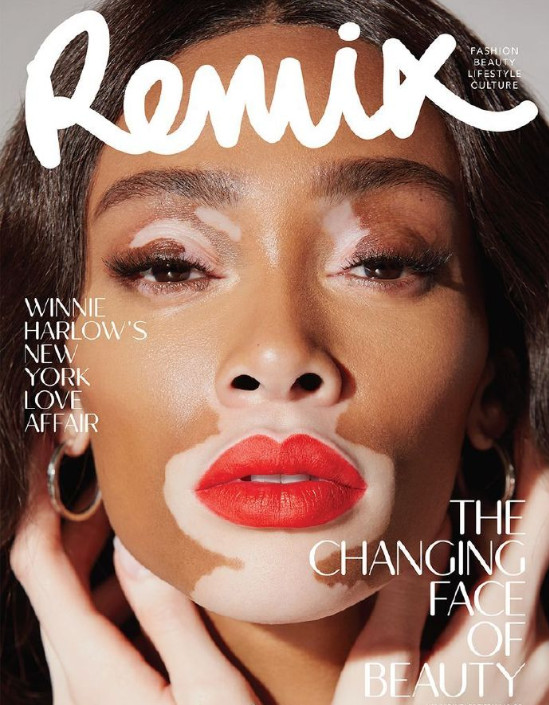 欧美美女名模Winnie Harlow Remix杂志封面大片