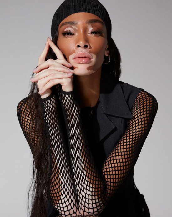 欧美美女名模Winnie Harlow Remix杂志封面大片