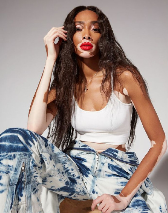 欧美美女名模Winnie Harlow Remix杂志封面大片